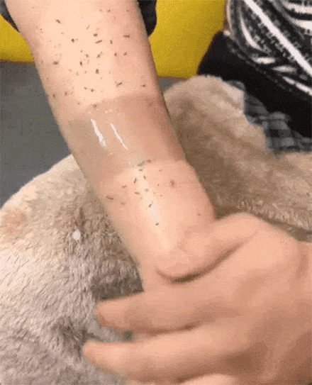 Exfoliating Gel forAcanthosis Nigricans,Focus on creating softand radiant skin